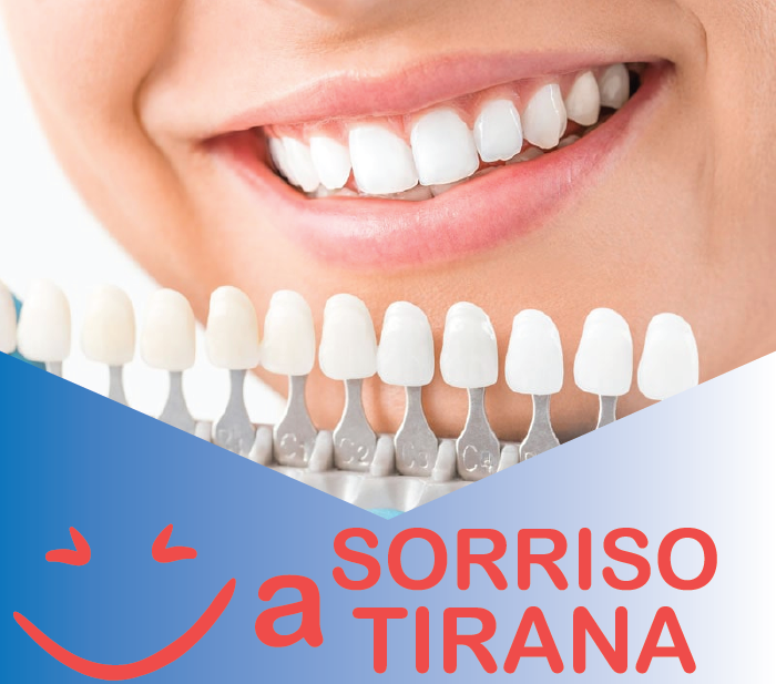 SORRISO A TIRANA